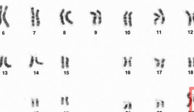 Pria Diprediksi 'Punah' 14 Abad Lalu, Kini Ilmuwan Membuktikannya