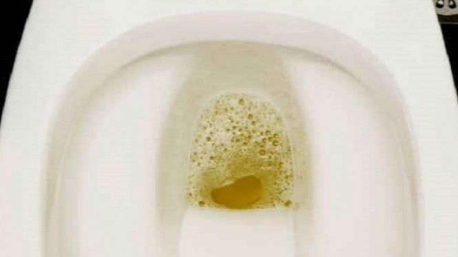 7 Bahaya Jika Urine Anda Sudah Berbuih