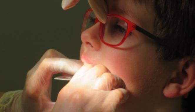 Gigi Rusak Bisa Picu 4 Penyakit Berbahaya ini