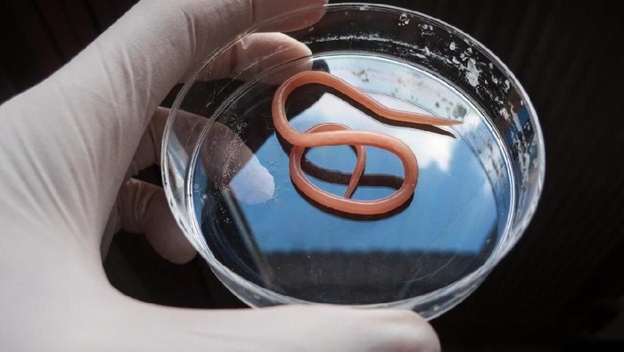 Pilu Balita di Sukabumi Meninggal, Ini Bahaya Cacingan yang Kerap Dianggap Sepele