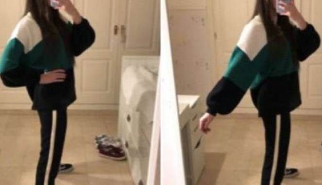 Foto Ini Jadi Viral, Apakah Wanita Ini Memiliki Satu Kaki?