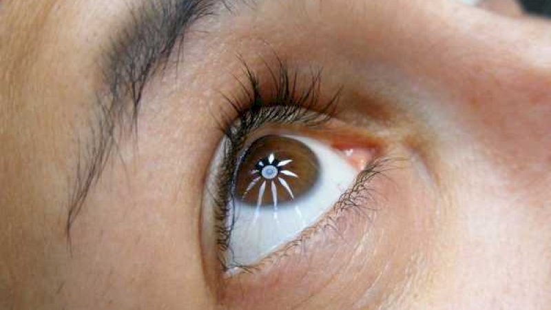 Hebat! Pertama di Dunia, Klinik Ini Berhasil Melakukan Transplantasi Kornea Buatan