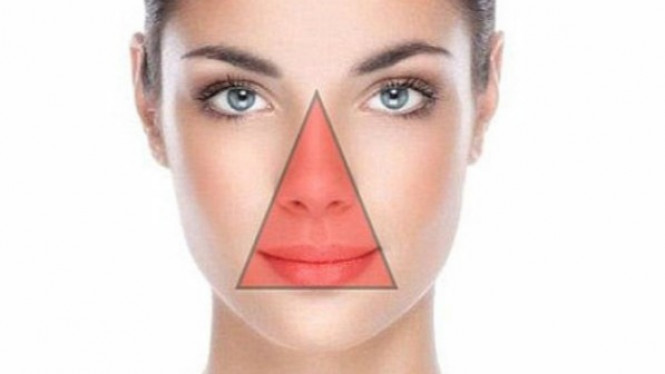 Berbahaya, Jangan Pecahkan Jerawat di Area 'Segitiga Kematian'