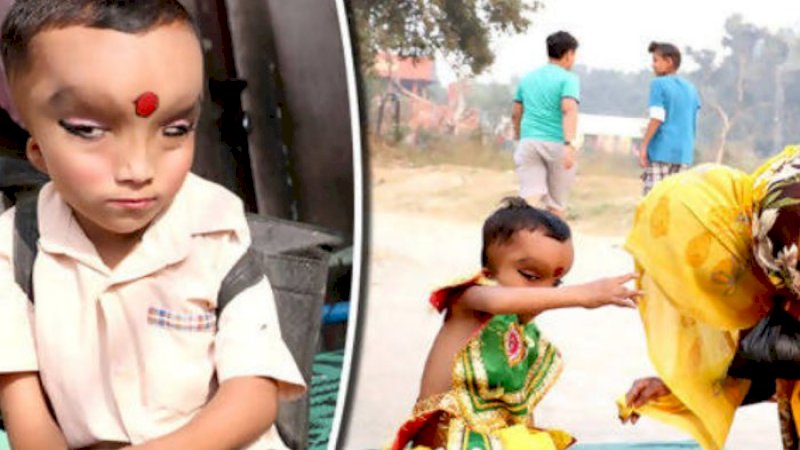Bocah Ini Dipuja dan Dianggap Titisan Dewa Karena Idap Kelainan Wajah