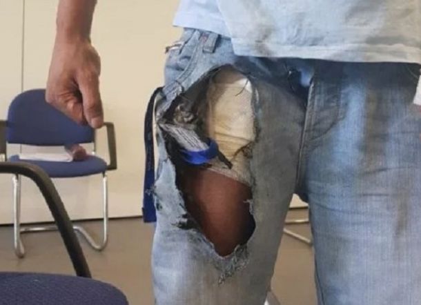 Rokok Elektrik Meledak 2 Inci dari Selangkangan