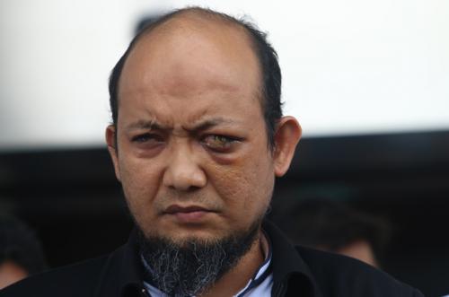 1 Tahun Berlalu, Kenapa Polri Tak Mampu Mengungkap Kasus Novel Baswedan?