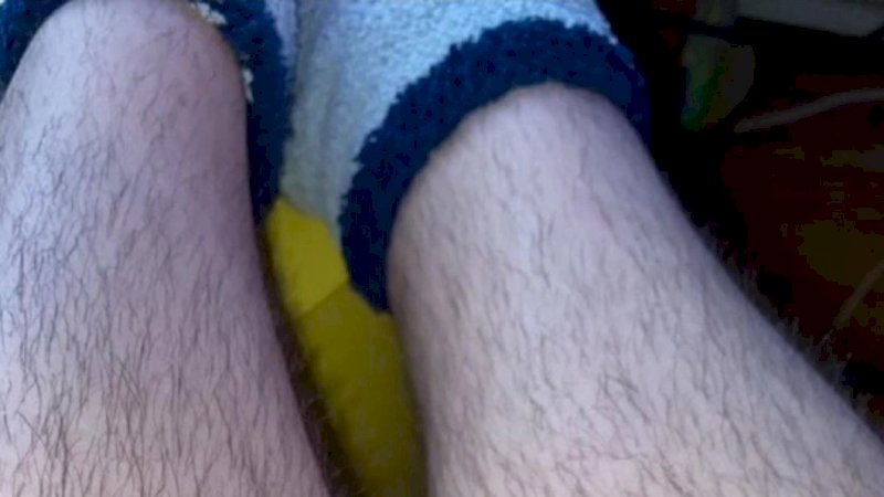 Pasangan Ini Putus Cuma Gara-gara Bulu