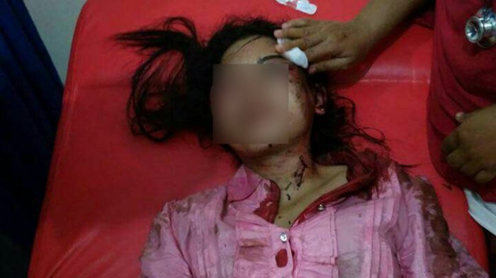 Wanita ini Nyaris Tewas Setelah Dianiaya dan Diperkosa Oleh Teman Baru Dikenalnya Lewat Handphone