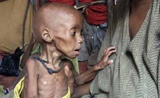 Ratusan ribu warga Somalia terancam tewas kelaparan