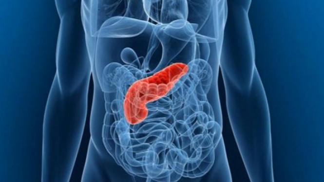 Lima Tanda Kanker Pankreas yang Sering Diabaikan