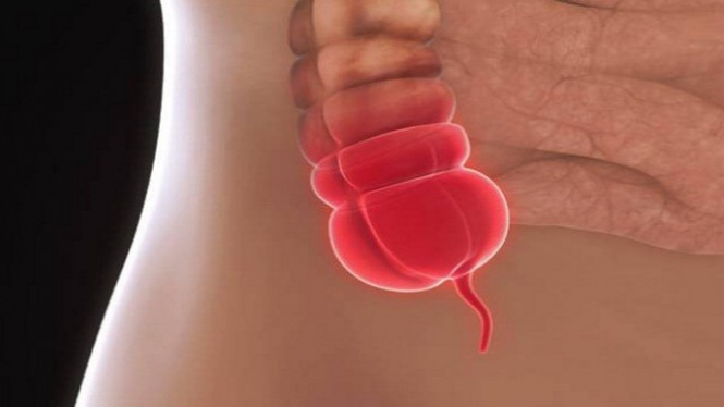 Tak Ingin Terkena Usus Buntu? Tinggalkan 8 Kebiasaan Buruk Ini