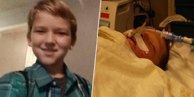 Bocah Autis 10 Tahun Dianiaya dan Dibakar Teman Sepermainan