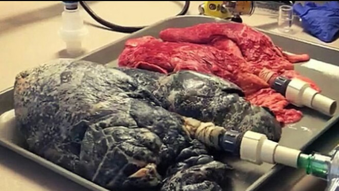 Video Ini Tunjukkan Perbedaan Paru-paru Sehat dan Perokok