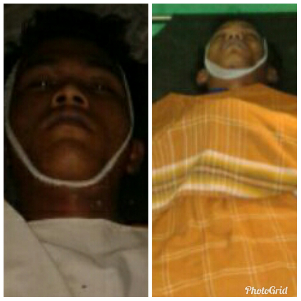 Berteduh di Pondok, Saudara Kembar Tewas Tersambar Petir