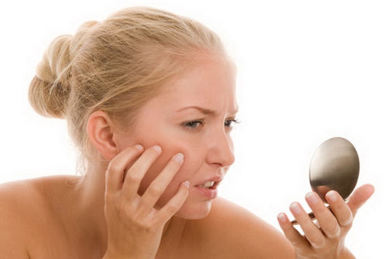 Apa Benar Jerawat Penyakit Keturunan?