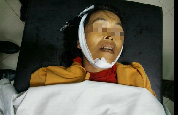 Polisi Terus Dalami Kematian PRT di Pekanbaru, Empat Orang Saksi Diperiksa