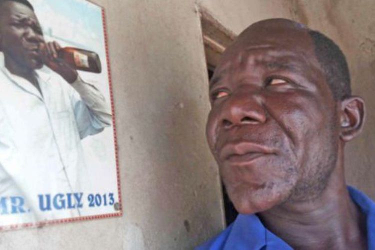 Inilah Pemenang Pria Terjelek 4 Kali Kontes Orang Terjelek di Zimbabwe