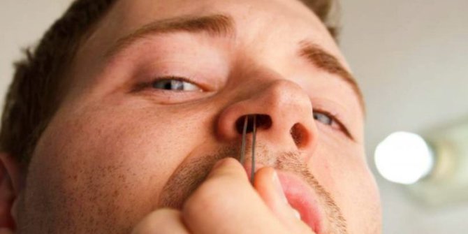 Ada Sejumlah Bahaya yang Bisa Muncul dari Kebiasaan Mencabuti Bulu Hidung