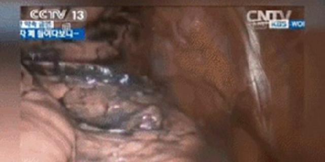 Asuransi Perokok, keluar-Masuk RUU Tembakau