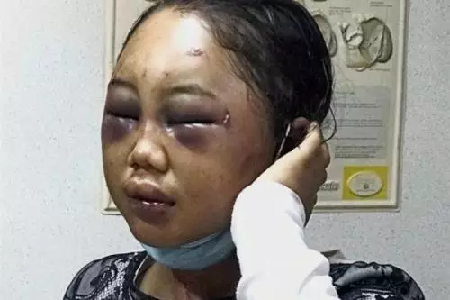 Kasus Disidangkan Kembali, Majikan Penyiksa TKW Suyanti Menghilang