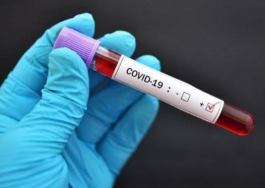 Kasus Corona di Riau Hari Ini Bertambah 46 Kasus, 9 Diantaranya Anak-anak dan 2 Bayi