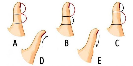 Bentuk Jempol Bisa Ungkap Banyak Hal, Simak disini!