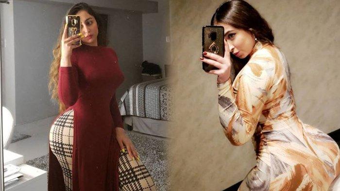 Selebgram Cantik Bergelimang Uang Setelah Operasi Plastik Bagian Sensitif Senilai Rp 882 Juta