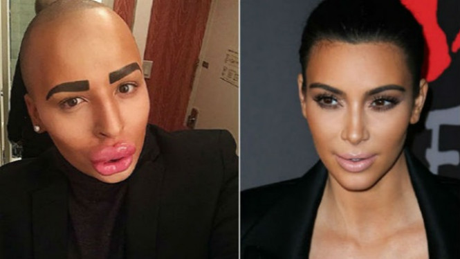 Lima Orang Ini Habiskan Banyak Uang demi Mirip Orang Lain