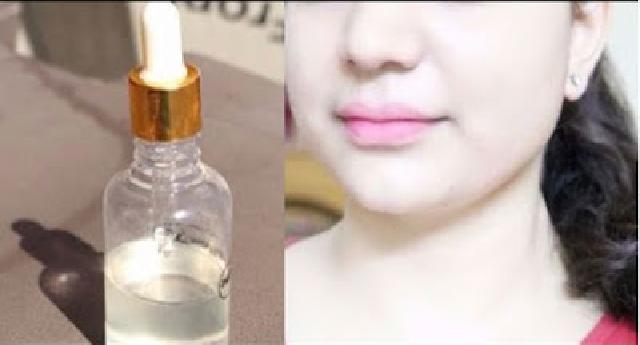 Hilangkan Flek Pada Wajah Dalam 5 Hari Secara Alami