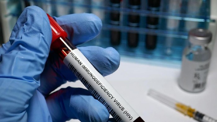 Pengidap HIV-AIDS Terbanyak di Kalangan Karyawan dan Ibu Rumah Tangga