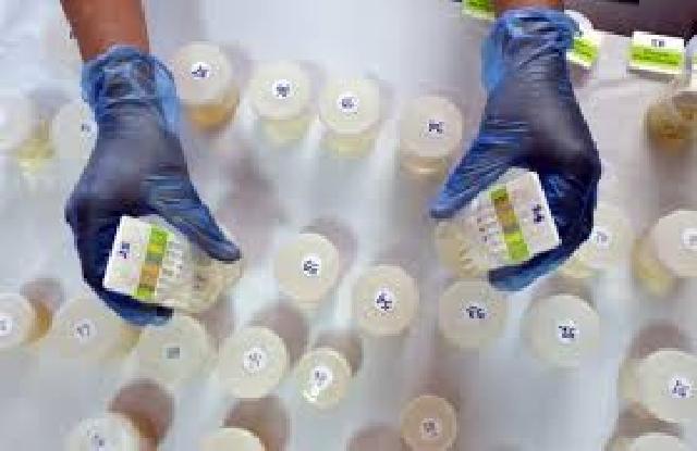 Yose Berharap Tes Urine di DPRD Bisa Segera Dilakukan