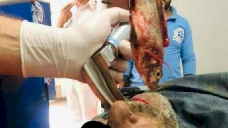 Kondisinya Terancam, Beruntung Ikan Hidup Berhasil Dikeluarkan dari Tenggorokan Nelayan