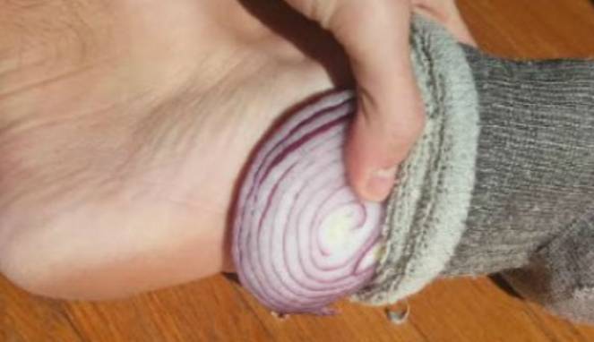 Memasukkan Bawang ke Kaus Kaki Ampuh Sembuhkan Flu?