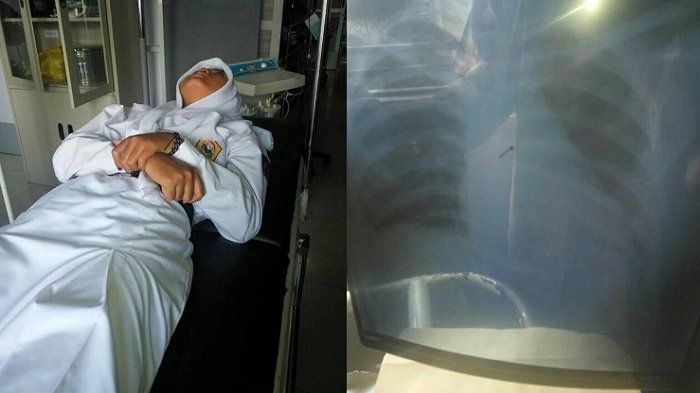 Gara-gara Gigit Jarum Pentul Saat Betulkan Hijab, Gadis Ini Alami Hal Menakutkan