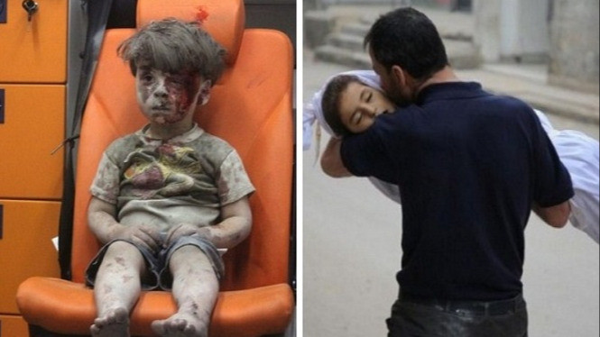 5 Kisah Sedih dan Tragis Anak Korban Perang Suriah