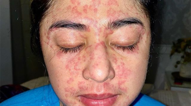 Foto-Foto Wajah Dewi Perssik Berubah Drastis Akibat Covid-19