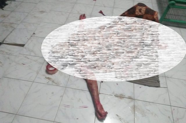 Ngeri, Disiram Air Keras Suami Asal Timur Tengah, Baju Perempuan Cantik di Cianjur sampai Sobek