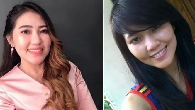 Wow, Ternyata Ini Potret Via Vallen Tanpa Make Up