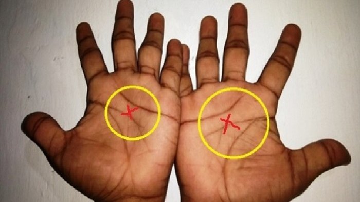 Ternyata ini Makna Tanda X di Telapak Tangan, Hanya 3 Persen Orang yang Memilikinya