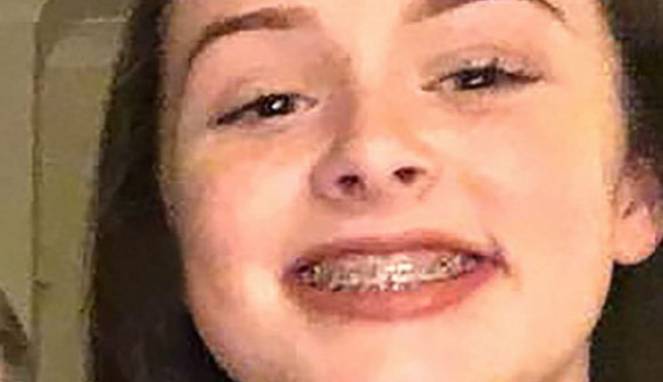 Gara-gara Pakai Kawat Gigi, Gadis Ini Terkena Stroke