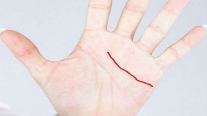 Punya Garis Tangan Ini? Anda Beruntung