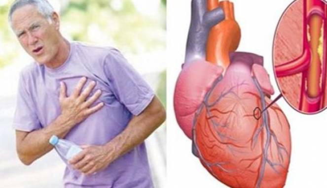 4 Kebiasaan Sepele Ini Picu Kerusakan Jantung