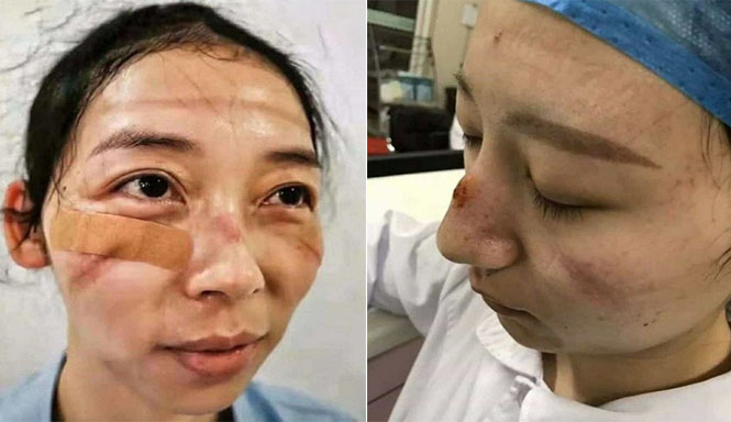 8 Potret Pilu Perjuangan Tim Medis Rawat Pasien Virus Corona