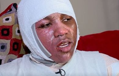 Usai Kiki Challenge, Kini Ada Lagi ‘The Hot Water Challenge’ Viral di Media Sosial, Jauh Lebih Bahay