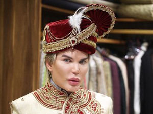 Terobsesi Jadi Boneka Hidup, Pria Ini Lakukan 58 Operasi Plastik Hingga Operasi Angkat 4 Tulang Rusu