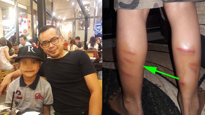 Viral Ayah Curhat Anaknya Dihukum Guru, Bekas Pukulan Penuhi Kaki, 'Hatiku Hancur & Aku Menangis'