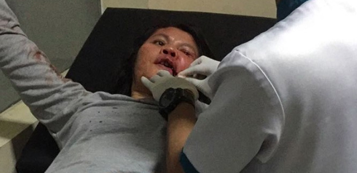 Siapa Saja Korban Kerusuhan Mako Brimob? Ini Penjelasan Polri