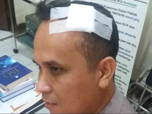 Usai Dipecat, Kombes Ekotrio Terancam Kode Etik dan Pidana Penjara