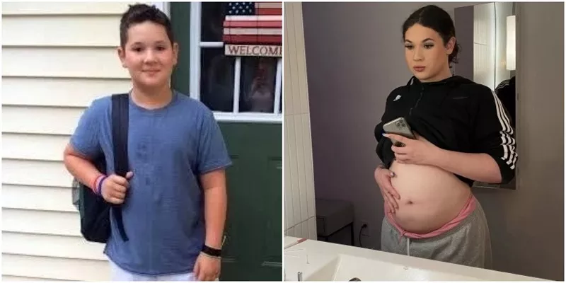 Bikin Heboh! Remaja 'Pria' Hamil, Kok Bisa?