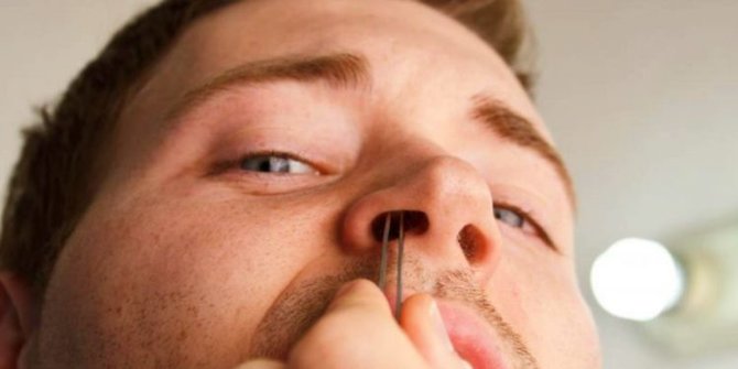 Ada Bahaya yang Mengancam dari Kebiasaan Mencabuti Bulu Hidung